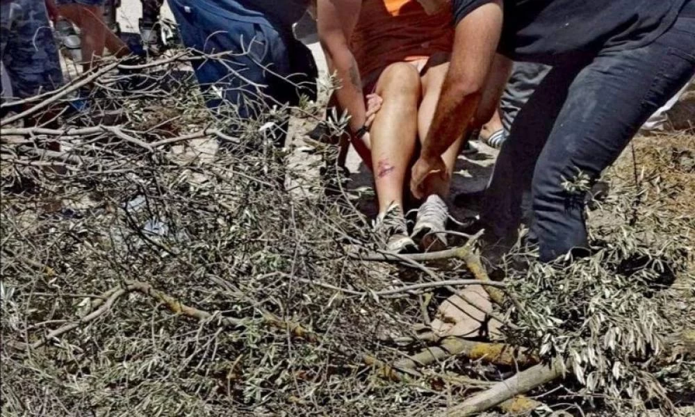 Έκρυθμη η κατάσταση στη Μόρια: Τραυματίστηκε ο αστ. διευθυντής και πολίτες - Εικόνες